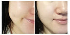 LABONITA Vital Hyaluronic Acid Serum skin hydration results Korean skincare
