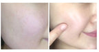 LABONITA Vital Hyaluronic Acid Serum skin hydration Korean skincare