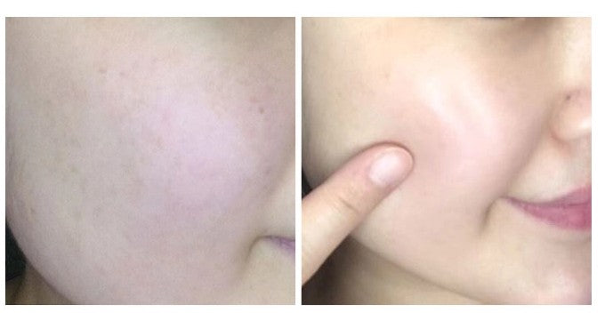 LABONITA Vital Hyaluronic Acid Serum skin hydration Korean skincare