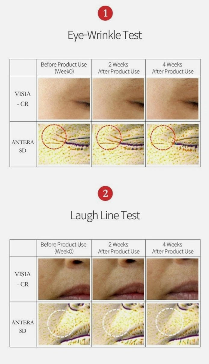 LABONITA Wrinkle Skincare Before and After Skin Improvement